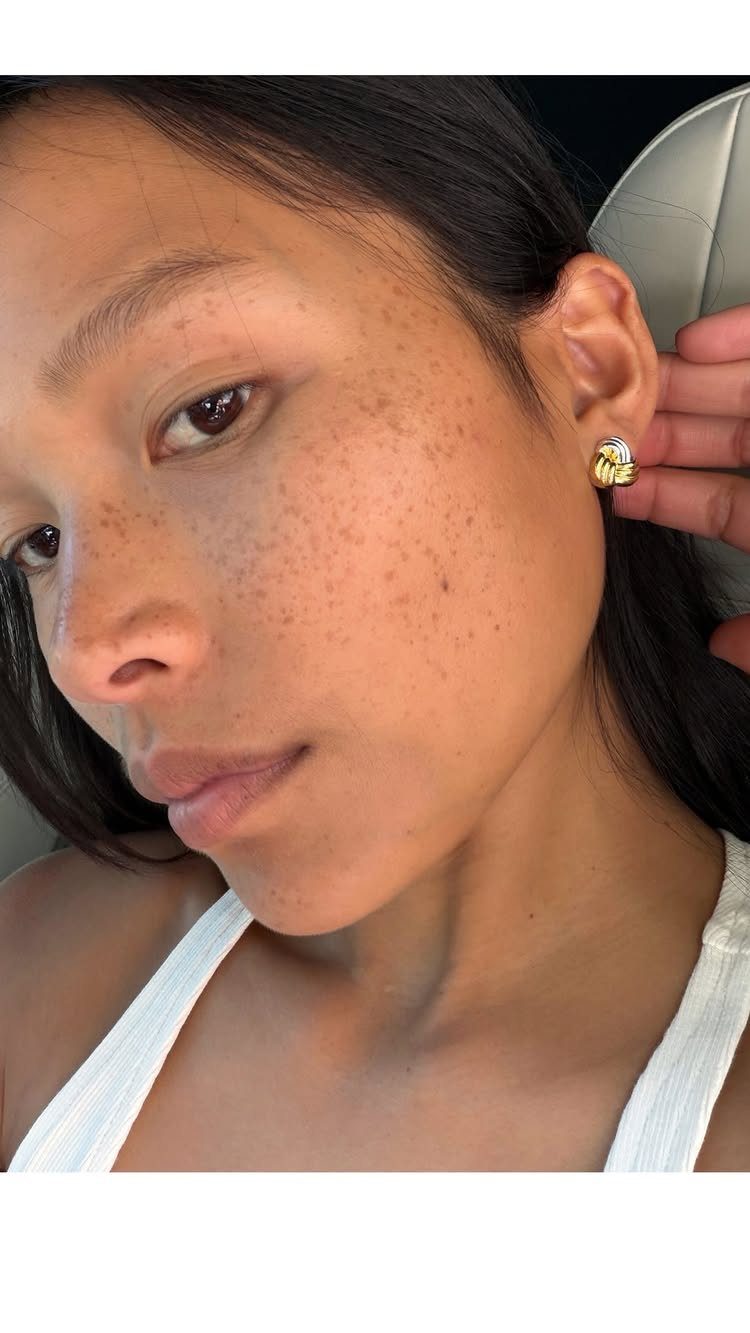 Woman with freckles wearing a gold double knot earring in her ear.